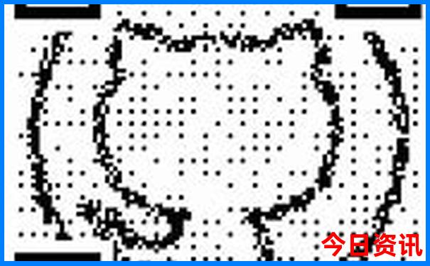 35选7基本走势图